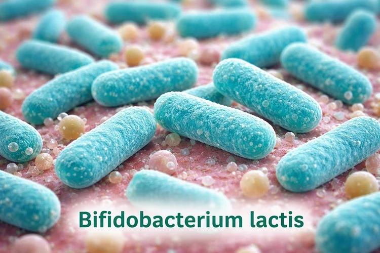Bifidobacterium lactis